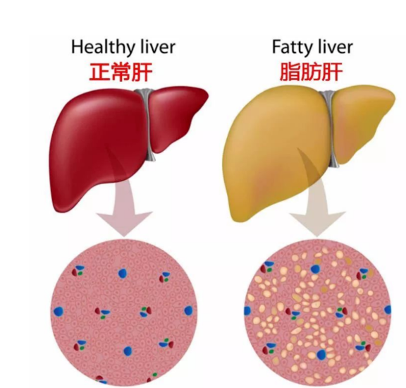 《人民日报》披露体检异常的前十名，看看你中了吗？体检异常保险怎么购买好？插图12