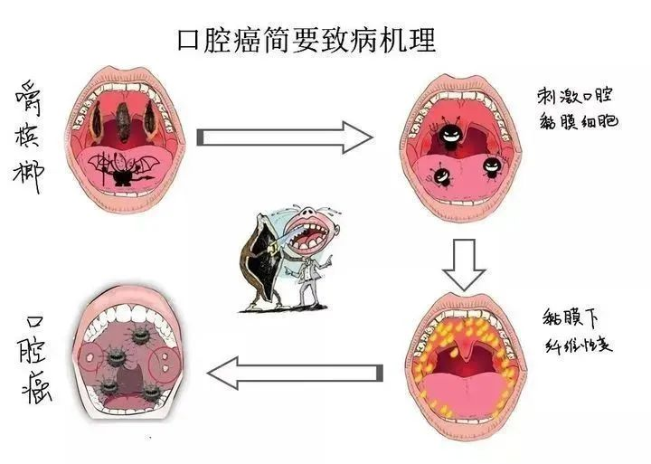 槟榔这类一级致癌物已被下架！普通人应该如何预防癌症？插图10