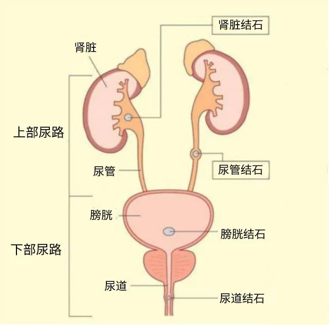有结石类的泌尿系统疾病可以买保险吗?有什么保险可以买呢?插图 有结石类的泌尿系统疾病可以买保险吗?有什么保险可以买呢?插图